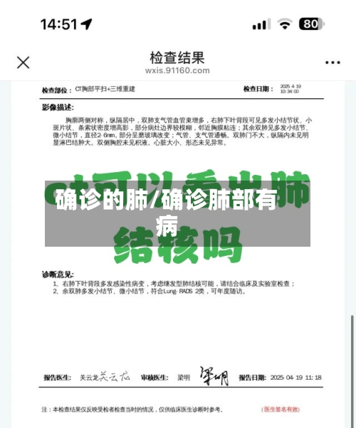 确诊的肺/确诊肺部有病-第2张图片