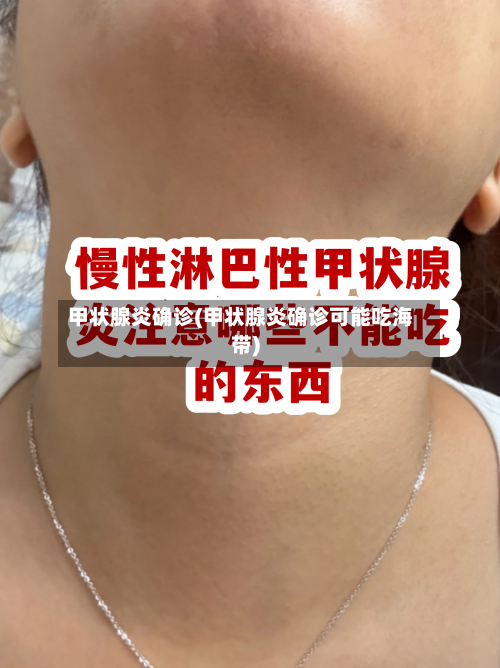 甲状腺炎确诊(甲状腺炎确诊可能吃海带)