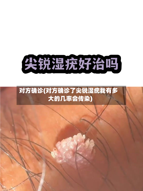 对方确诊(对方确诊了尖锐湿疣我有多大的几率会传染)