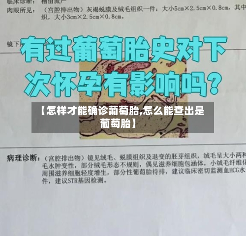 【怎样才能确诊葡萄胎,怎么能查出是葡萄胎】