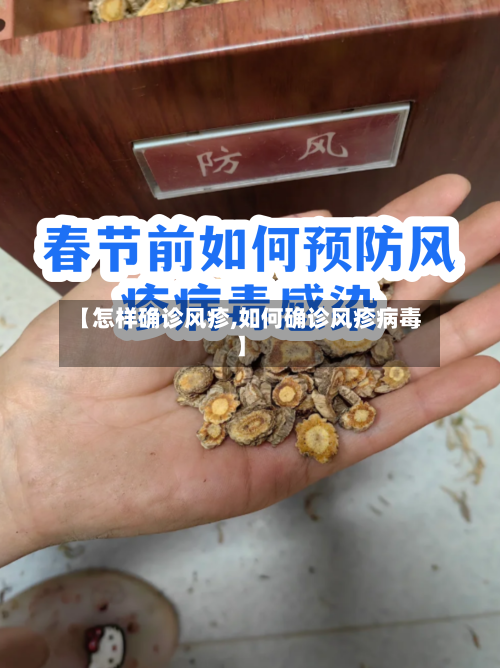 【怎样确诊风疹,如何确诊风疹病毒】-第2张图片