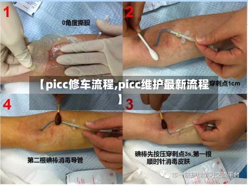 【picc修车流程,picc维护最新流程】-第2张图片