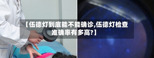 【伍德灯到底能不能确诊,伍德灯检查准确率有多高?】-第3张图片