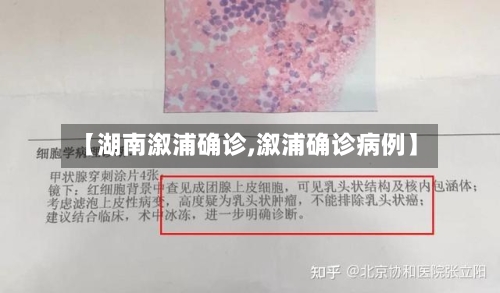 【湖南溆浦确诊,溆浦确诊病例】