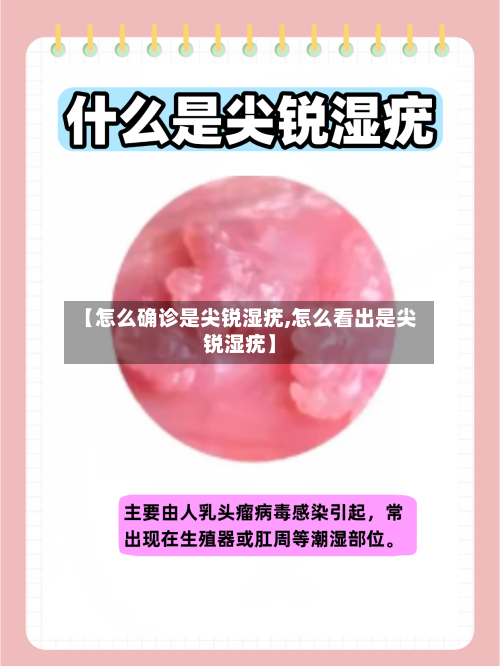 【怎么确诊是尖锐湿疣,怎么看出是尖锐湿疣】