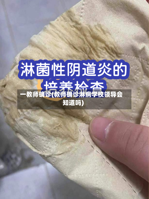 一教师确诊(教师确诊淋病学校领导会知道吗)