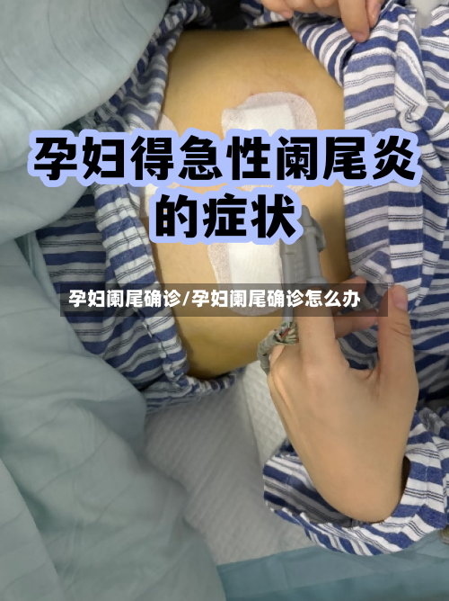 孕妇阑尾确诊/孕妇阑尾确诊怎么办-第2张图片