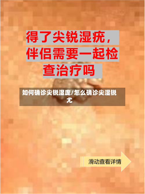 如何确诊尖锐湿庞/怎么确诊尖湿锐尤