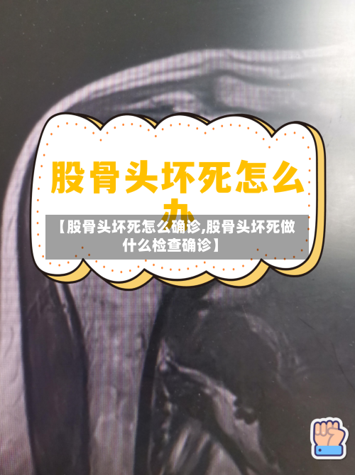 【股骨头坏死怎么确诊,股骨头坏死做什么检查确诊】-第3张图片