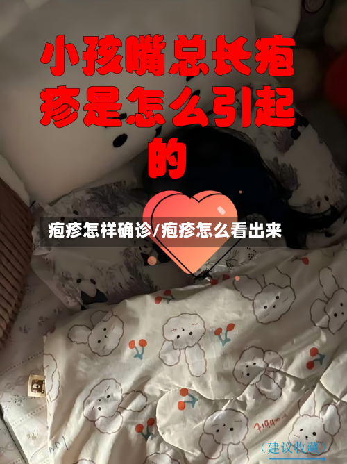 疱疹怎样确诊/疱疹怎么看出来-第3张图片