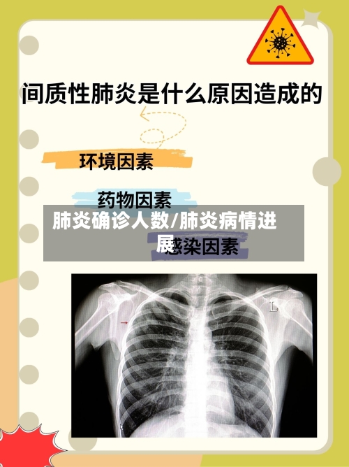 肺炎确诊人数/肺炎病情进展-第3张图片