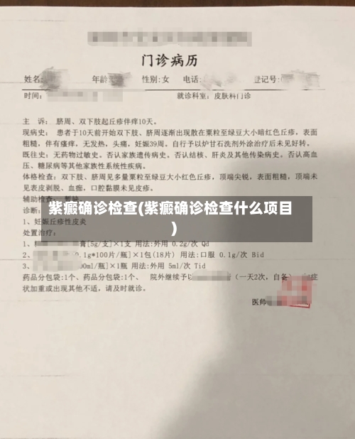 紫癜确诊检查(紫癜确诊检查什么项目)