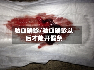 验血确诊/验血确诊以后才能开假条