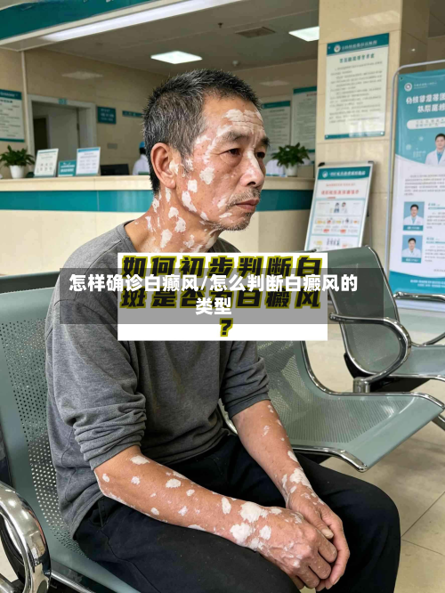 怎样确诊白癫风/怎么判断白癜风的类型