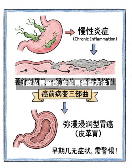 【皮革胃确诊,皮革胃检查方法】-第3张图片