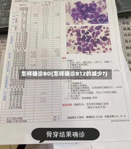 怎样确诊BO(怎样确诊B12的减少?)