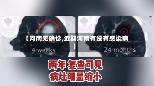 【河南无确诊,近期河南有没有感染病】-第3张图片