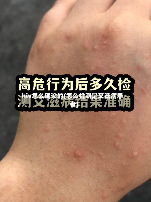 hiv怎么确诊的(怎么检测是艾滋病患者)