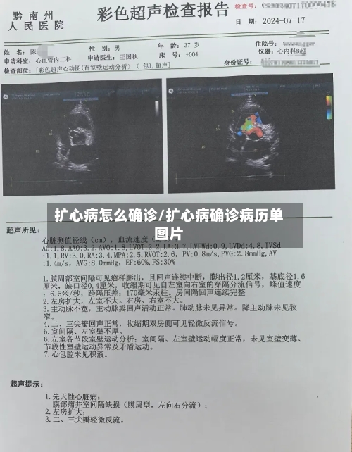 扩心病怎么确诊/扩心病确诊病历单图片