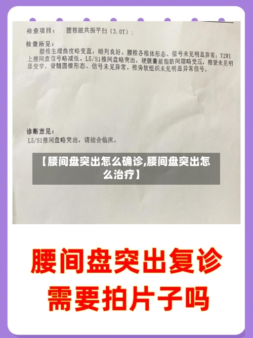 【腰间盘突出怎么确诊,腰间盘突出怎么治疗】-第2张图片