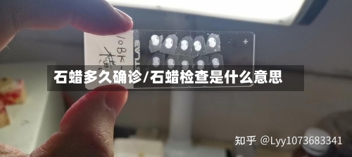 石蜡多久确诊/石蜡检查是什么意思-第2张图片