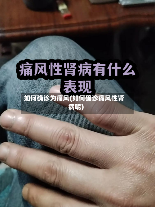 如何确诊为痛风(如何确诊痛风性肾病呢)