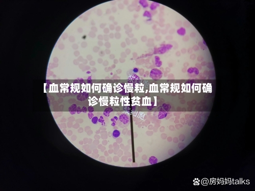 【血常规如何确诊慢粒,血常规如何确诊慢粒性贫血】-第2张图片