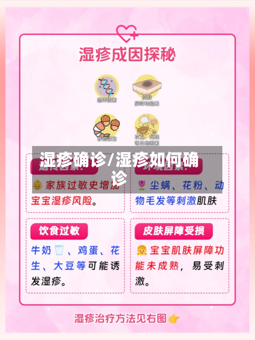 湿疹确诊/湿疹如何确诊