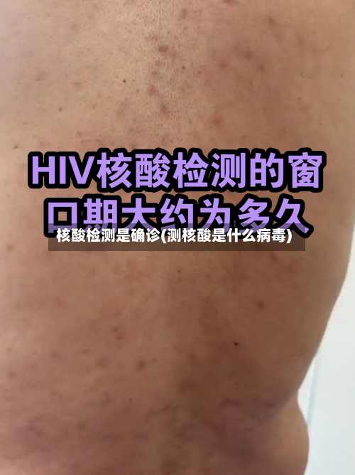 核酸检测是确诊(测核酸是什么病毒)