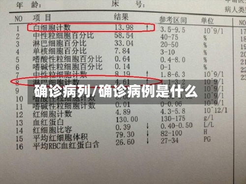 确诊病列/确诊病例是什么