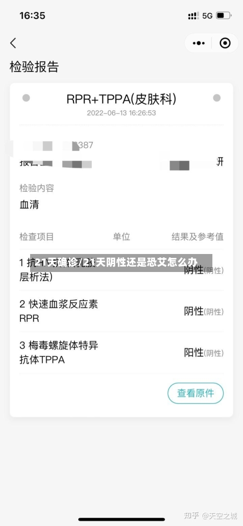 21天确诊/21天阴性还是恐艾怎么办-第2张图片