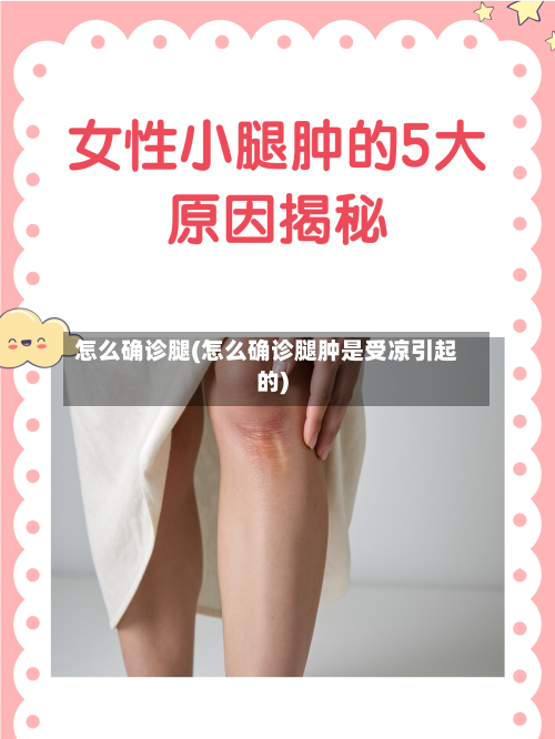 怎么确诊腿(怎么确诊腿肿是受凉引起的)-第2张图片