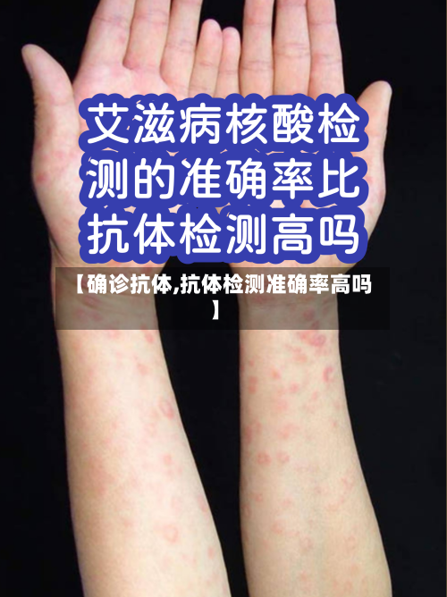 【确诊抗体,抗体检测准确率高吗】-第2张图片