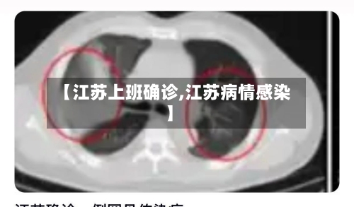 【江苏上班确诊,江苏病情感染】