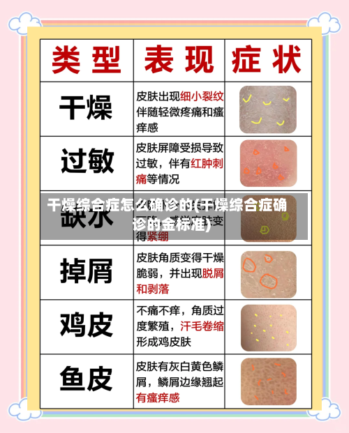 干燥综合症怎么确诊的(干燥综合症确诊的金标准)