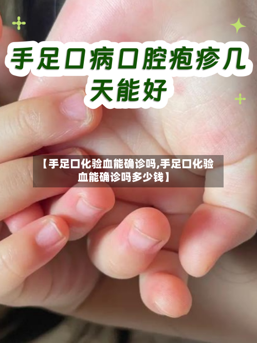 【手足口化验血能确诊吗,手足口化验血能确诊吗多少钱】