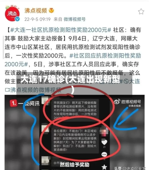 大连17确诊(大连出现新型)-第3张图片