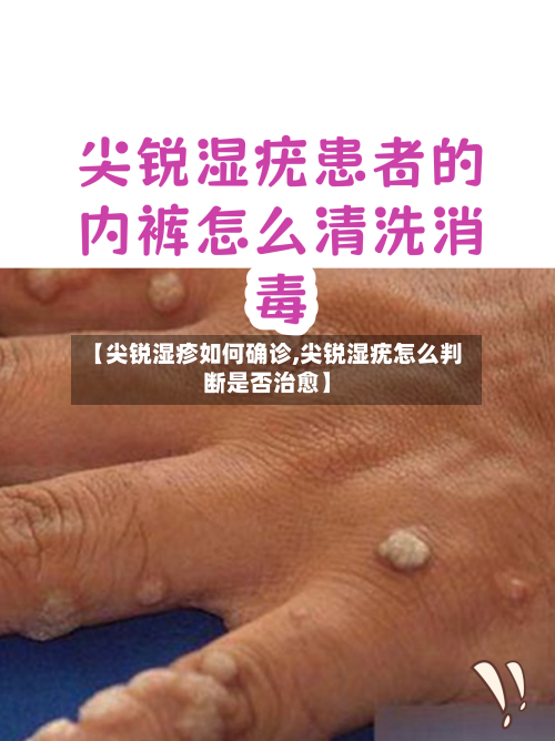 【尖锐湿疹如何确诊,尖锐湿疣怎么判断是否治愈】-第2张图片