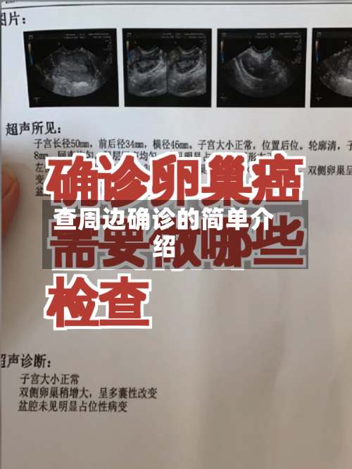查周边确诊的简单介绍