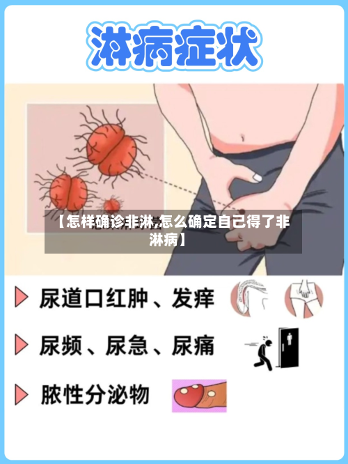 【怎样确诊非淋,怎么确定自己得了非淋病】