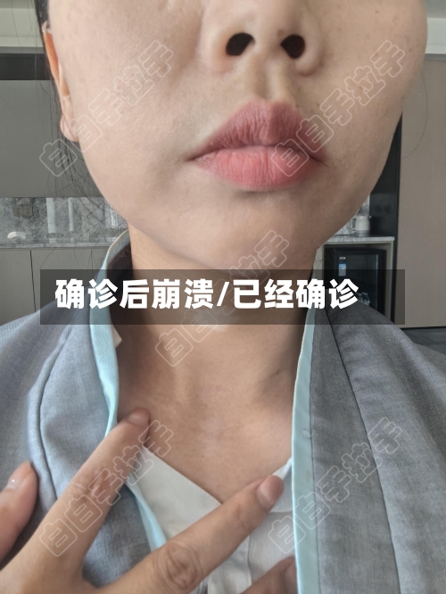 确诊后崩溃/已经确诊