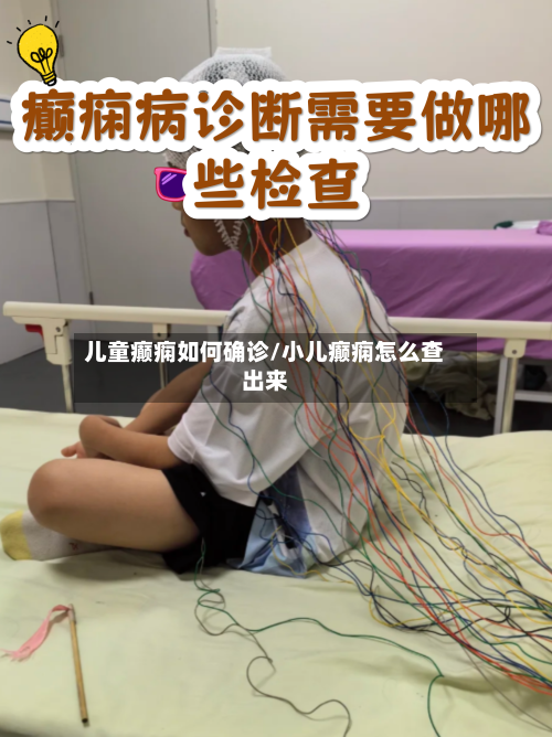 儿童癫痫如何确诊/小儿癫痫怎么查出来