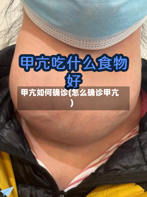 甲亢如何确诊(怎么确诊甲亢)