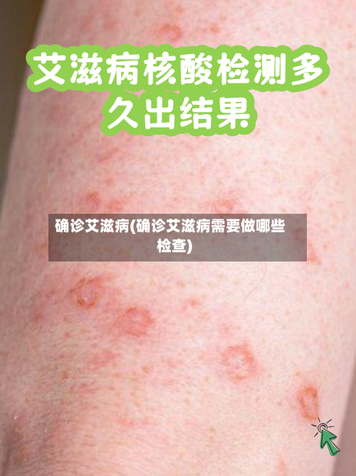 确诊艾滋病(确诊艾滋病需要做哪些检查)
