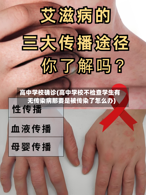 高中学校确诊(高中学校不检查学生有无传染病那要是被传染了怎么办)-第2张图片