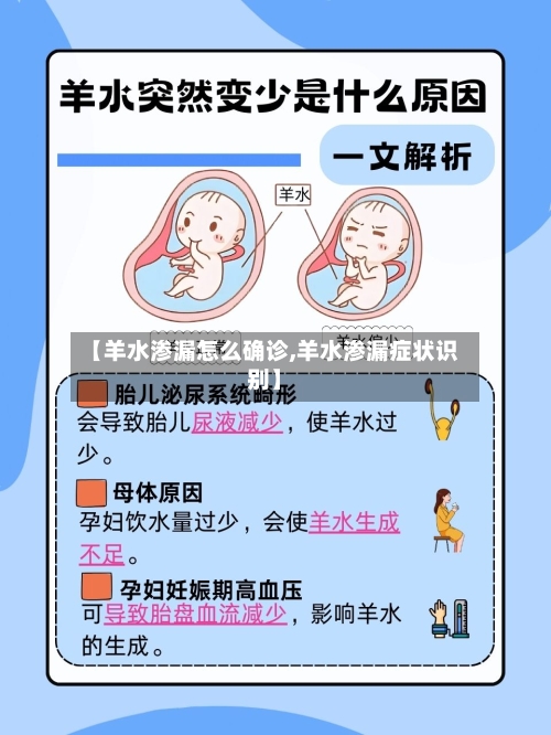 【羊水渗漏怎么确诊,羊水渗漏症状识别】