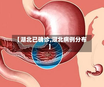 【湖北已确诊,湖北病例分布】-第2张图片