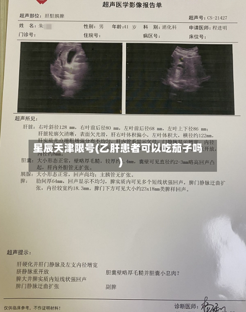 星辰天津限号(乙肝患者可以吃茄子吗)-第3张图片