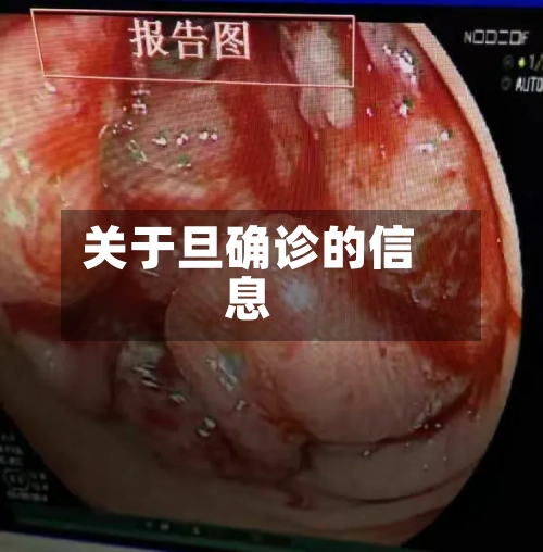 关于旦确诊的信息-第2张图片
