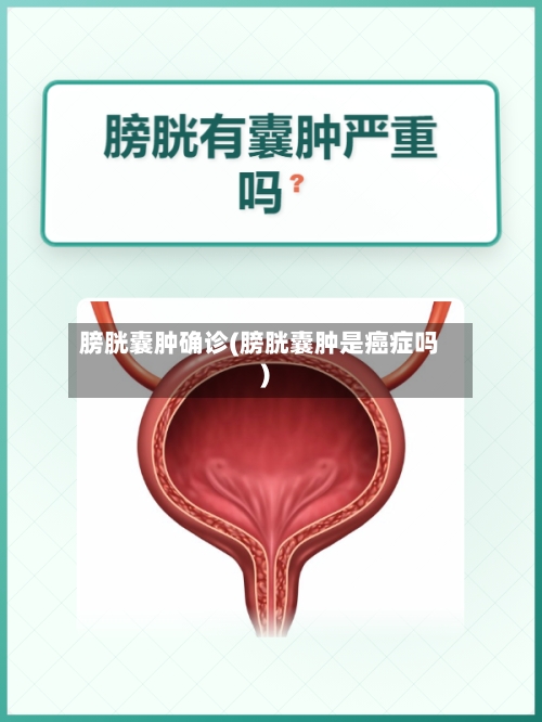 膀胱囊肿确诊(膀胱囊肿是癌症吗)-第2张图片